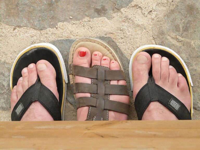 Can Flip-Flops Cause Foot Pain? | Red Mountain Footcare