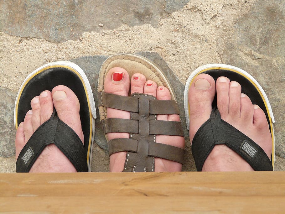 Bad toes in hot sale flip flops