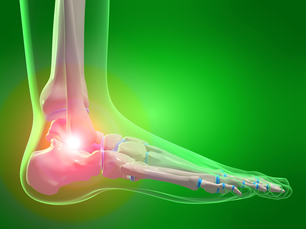 posterior ankle impingement syndrome