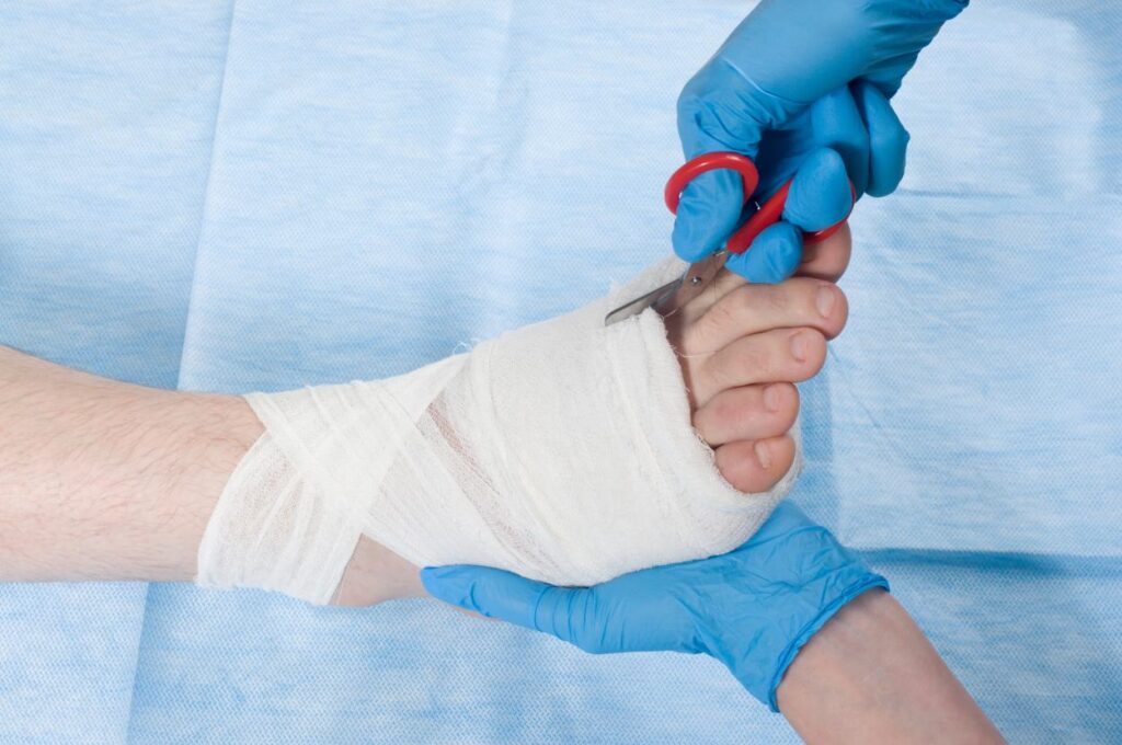 Physician treating bandaged foot