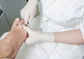 Ingrown Toenail Treatment