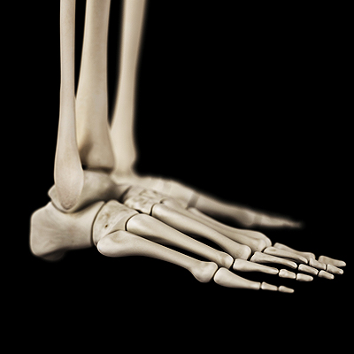 stress fractures in foot